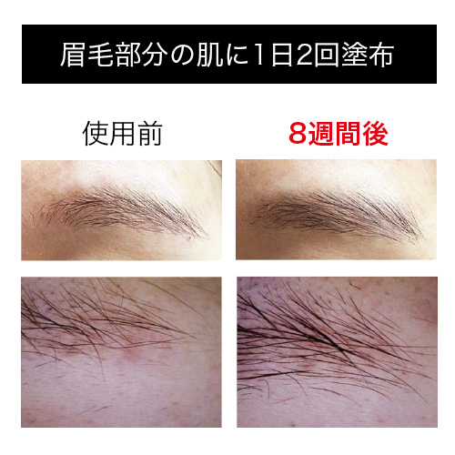 ペロバーム ブローブロー 10mlのイメージ画像